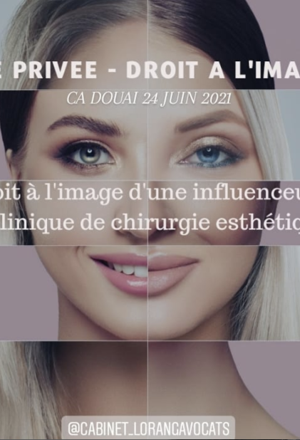 Droit à l'image d'une influenceuse